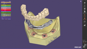 Exocad DentalCAD数字化牙科CAD CAM软件-知遇博客