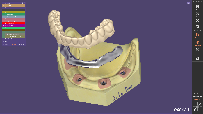 Exocad DentalCAD数字化牙科CAD CAM软件-知遇博客