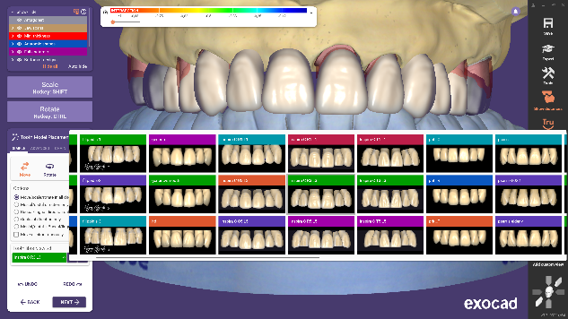 图片[4]-Exocad DentalCAD数字化牙科CAD CAM软件-知遇博客