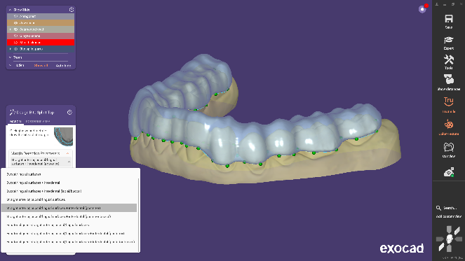 图片[6]-Exocad DentalCAD数字化牙科CAD CAM软件-知遇博客