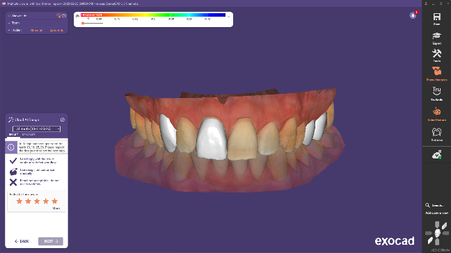 图片[5]-Exocad DentalCAD数字化牙科CAD CAM软件-知遇博客
